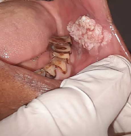 Audiologist