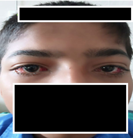 Responsive Image