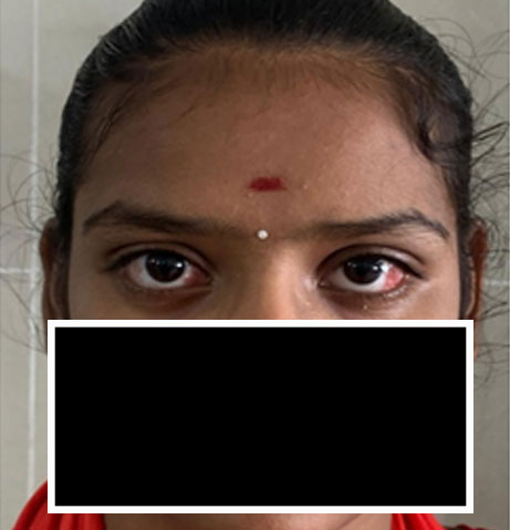 Responsive Image